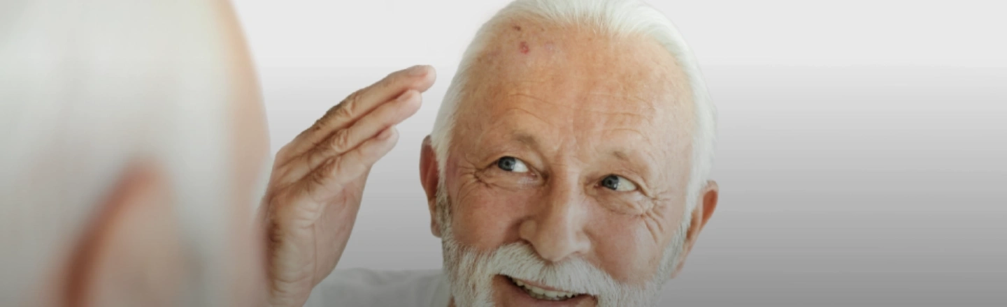 cabecera-desktop-queratosis-actinica-1440x440