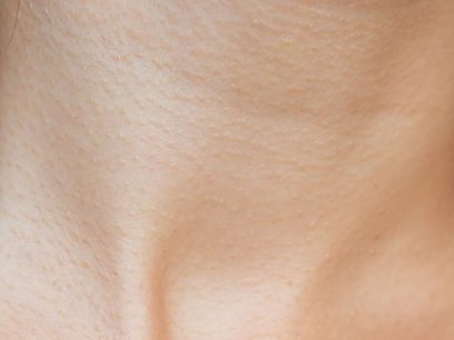 438.-como-cuidar-y-proteger-la-piel-del-sol-dermatologa-maria-porrino