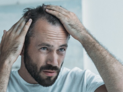 Mitos de la alopecia