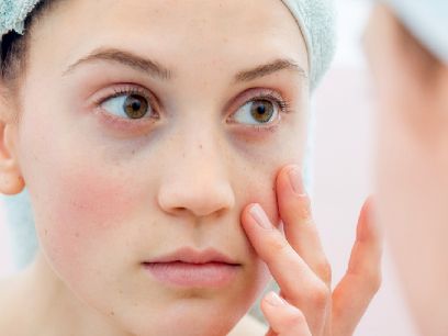 170.-bolsas-y-ojeras-por-que-se-producen-y-como-tratarlas