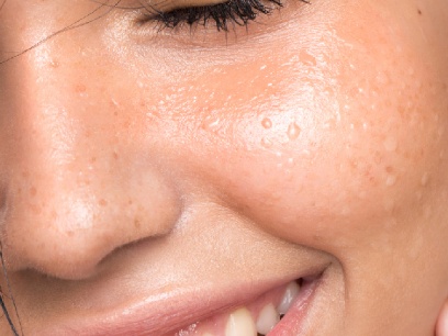 Función barrera cutánea