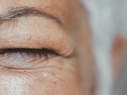 Por qué envejece la piel