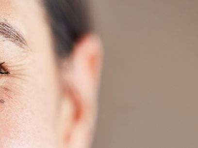 25.-hiperpigmentacion-en-la-piel-por-que-se-produce-y-como-evitarla