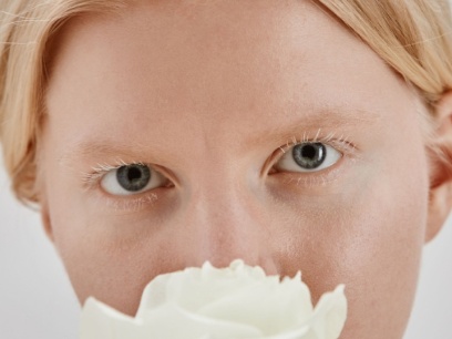 albinismo en África