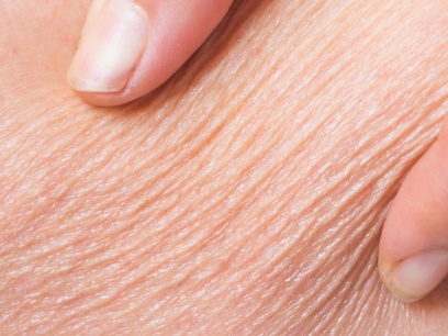 Mitos de la dermatología