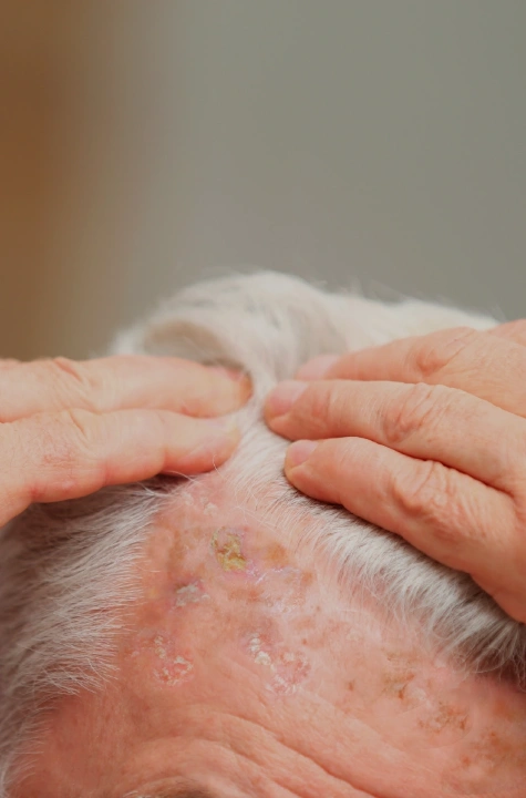 aktuva-triple-image3