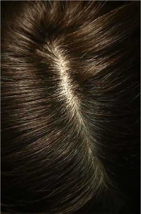 Ampollas bebibles Iraltone