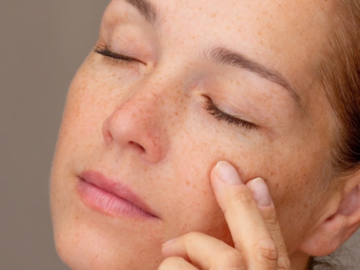 eliminar manchas faciales