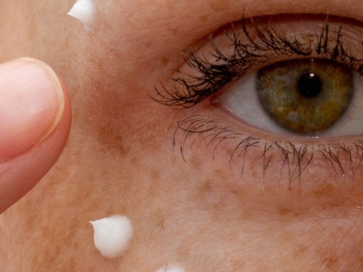 manchas en la cara en verano