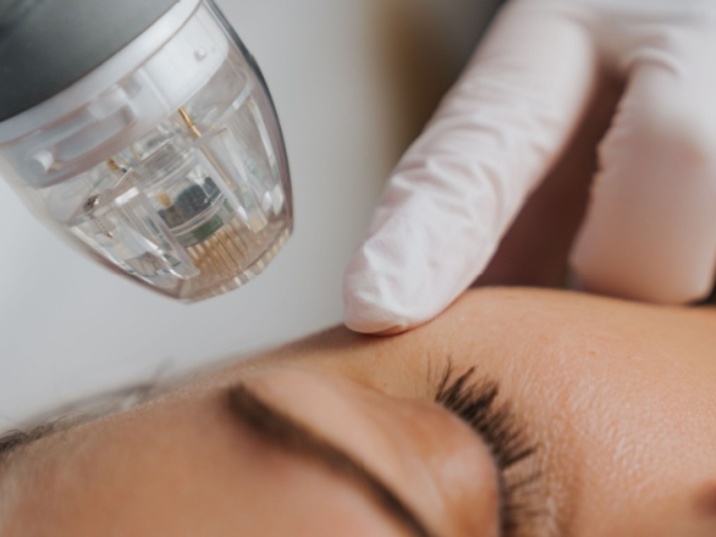 prevenir la queratosis actínica