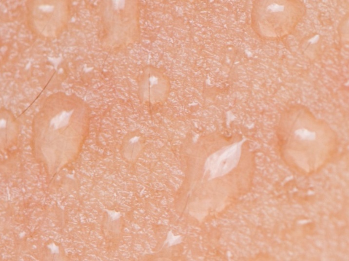 correcta hidratación