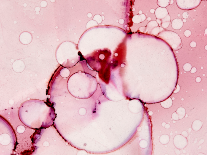 qué son los antioxidantes