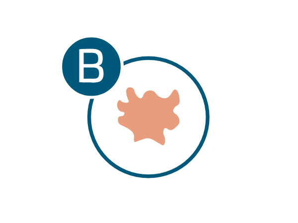 melanoma-regla-b