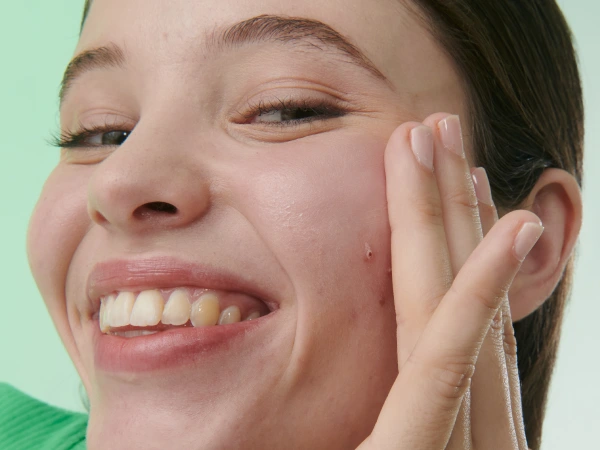 Biretix isorepair Beneficios_600x450-09