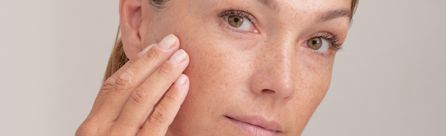 manchas marrones en la cara