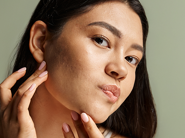 Biretix_beneficio_resultados