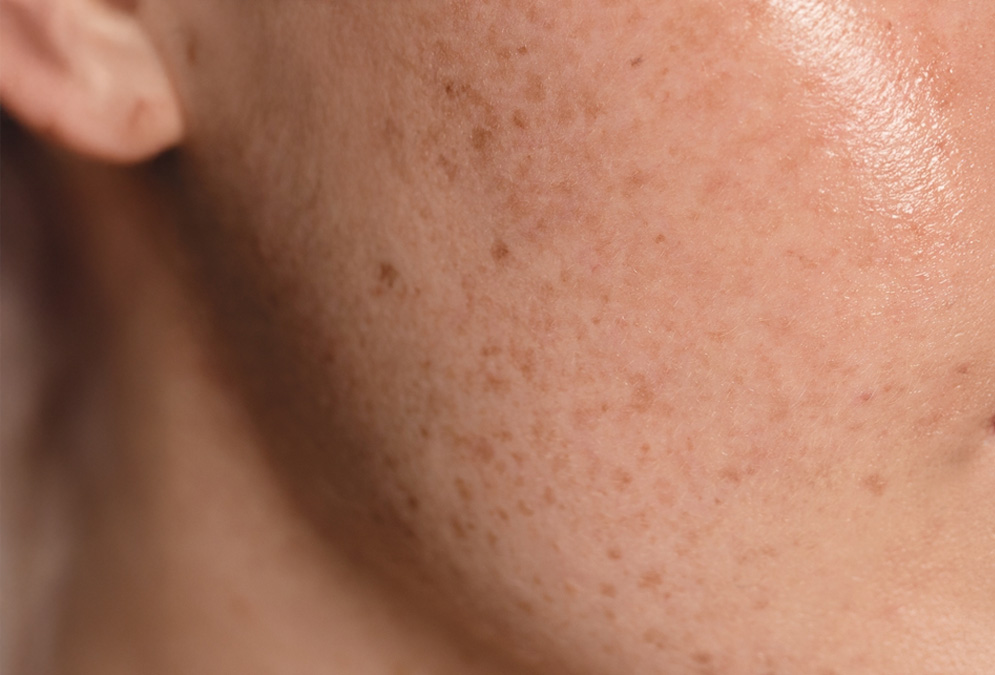 TextImg_Zinc_995x675-2