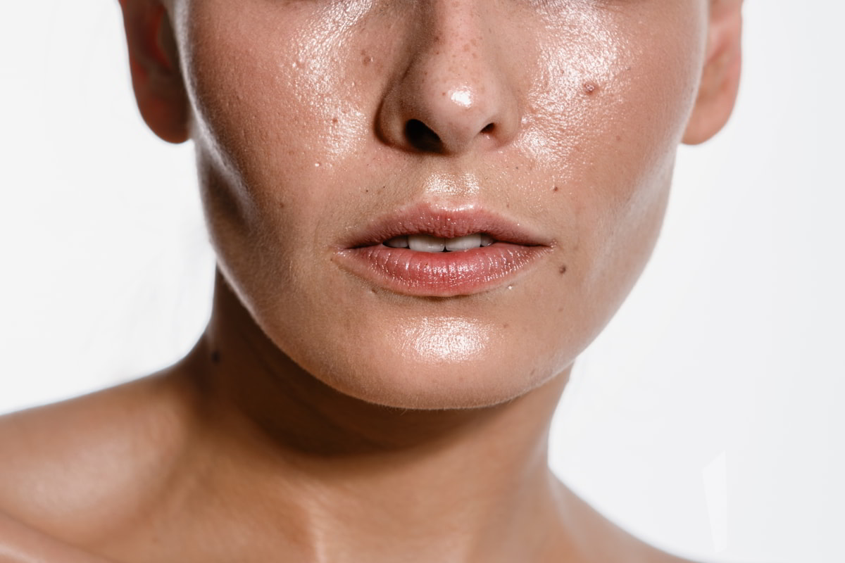 Controlar el sebo en las pieles acneicas